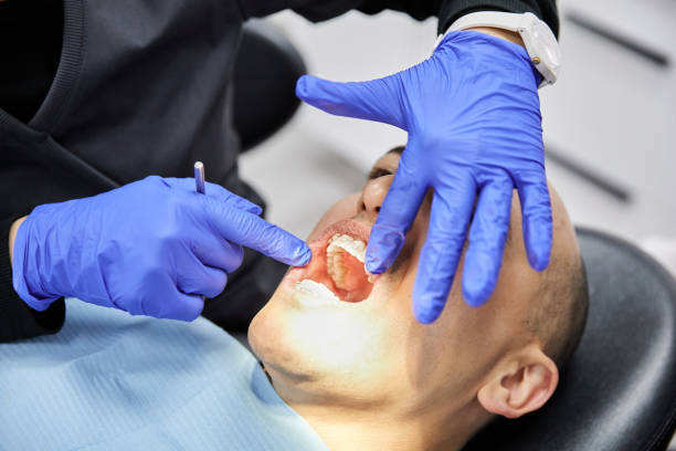 Best Emergency Dental Extractions in Tri City, OR